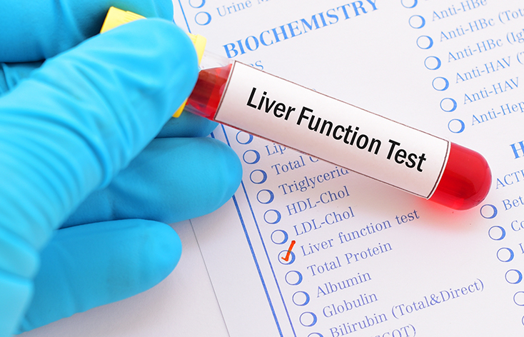 Liver Profile Test in Ludhiana